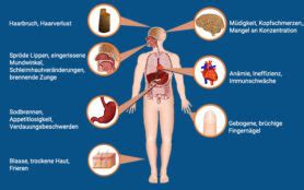 Was Sind Die Symptome Bei Eisenmangel