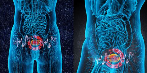 Was Sind Die Symptome Für Blasenkrebs