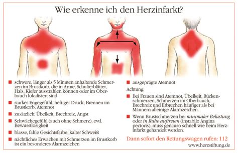 Was Sind Die Symptome Für Einen Herzinfarkt