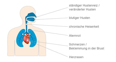 Was Sind Die Symptome Für Krebs