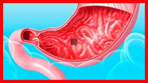 MAGEN NACH OBEN GERUTSCHT