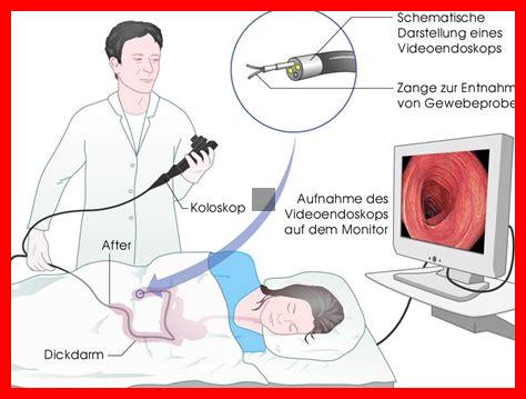 MAGEN UND DARMSPIEGELUNG ZUSAMMEN ERFAHRUNGEN